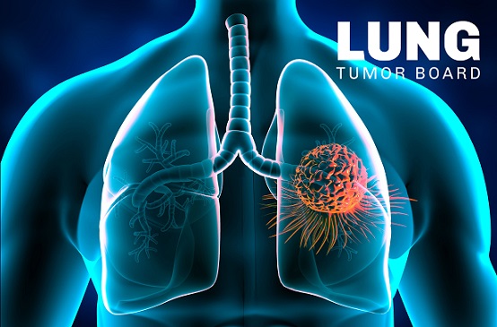 2024 EDW Multidisciplinary Lung Tumor Board (RSS) Banner